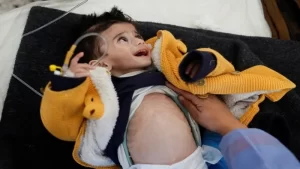 استشهاد 3 أطفال بمشفى الشفاء نتيجة سوء التغذية والجفاف