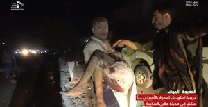 أفادت وزارة الصحة والبيئة باستشهاد وإصابة 26 مدنياً جراء غارات العدوان الأمريكي مساء أمس، على مدينة أمين مقبل السكنية في مديرية الحوك بمحافظة